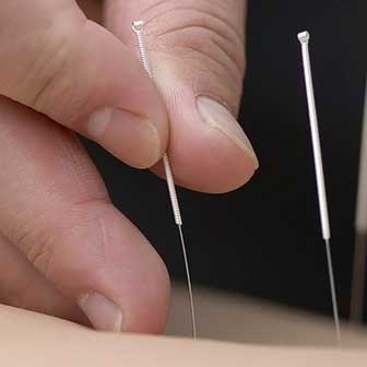 Disease Treated By Acupuncture